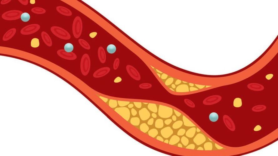 Как сервис доставки готовых рационов и корпоративных обедов помогает бороться с повышенным холестерином